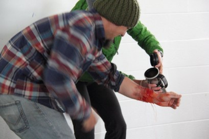 Serious burn. Cool it down immediately!